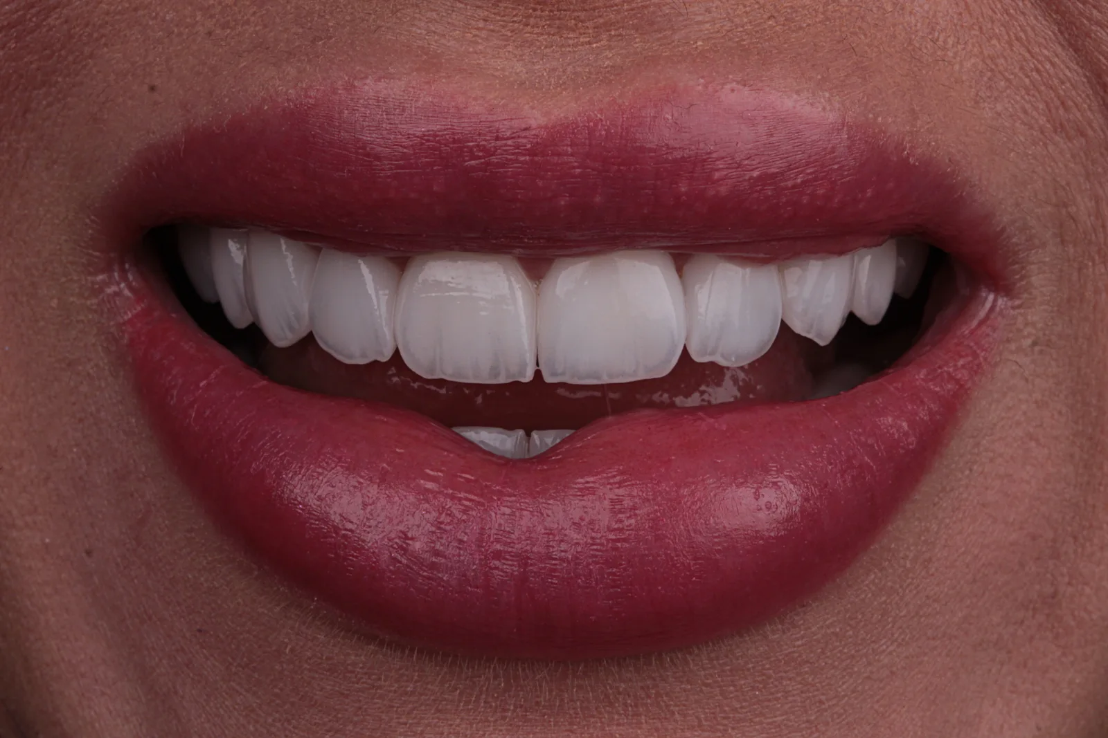 Porcelana BL2 · Acervo 01
