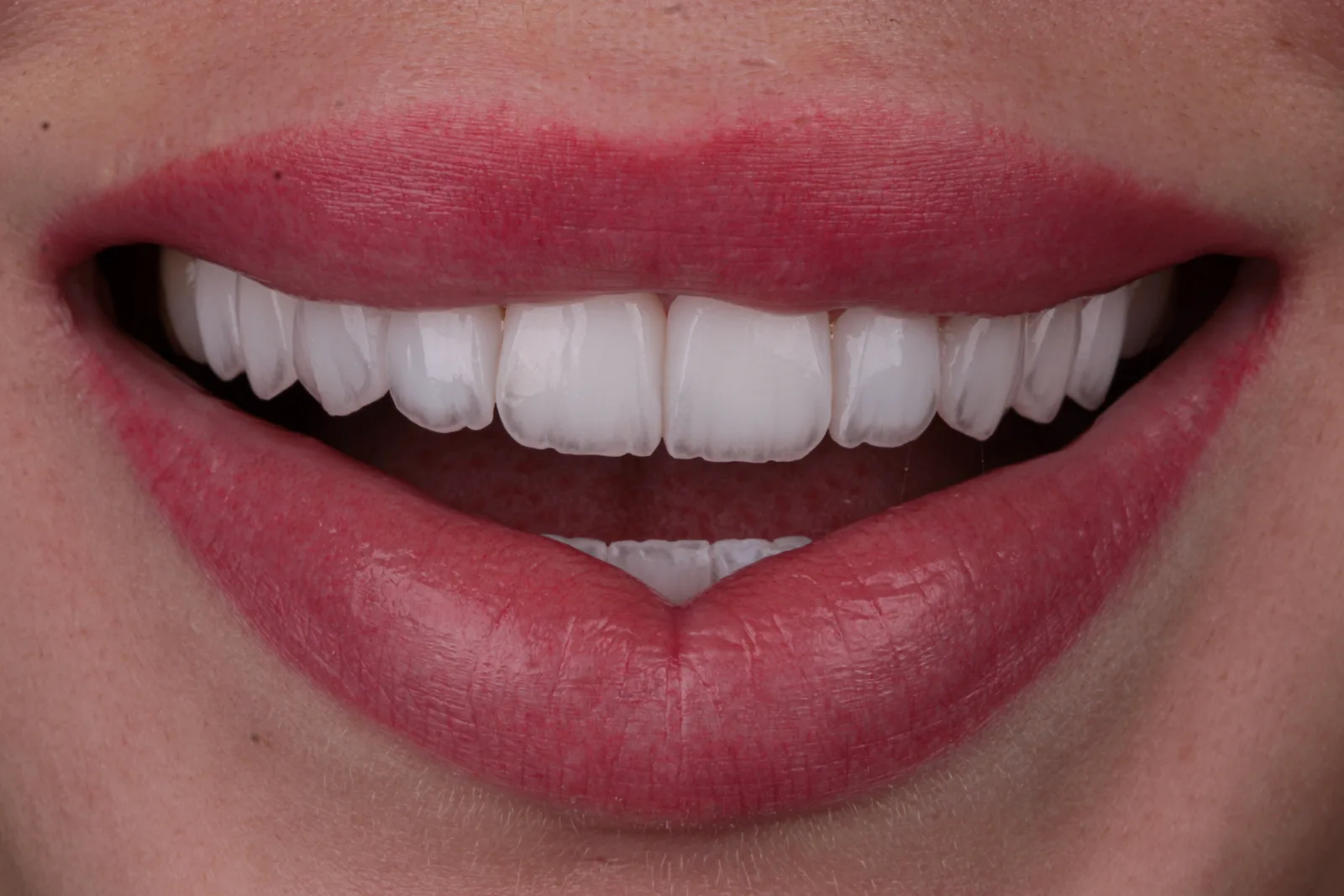Porcelana BL2 · Acervo 02